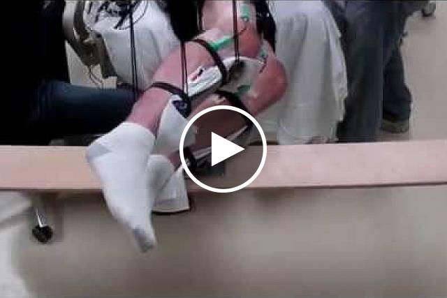 Video shows range of voluntary movement before and after transcutaneous stimulation. The subject's legs are supported so that they can move without resistance from gravity. The electrodes are used to record muscle activity. Edgerton laboratory / UCLA